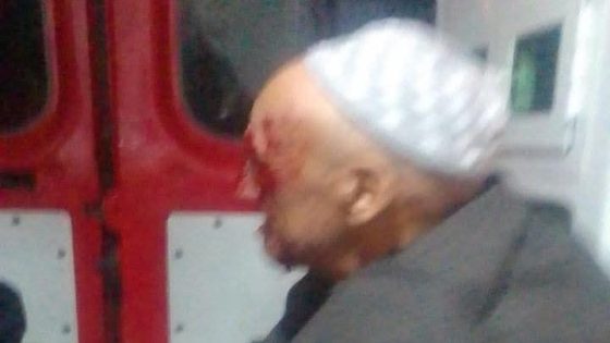 عيب و عار هادشي : مسن ضحية عملية دهس بدراجة نارية يتعرض للإهمال الطبي بعد نقله للمستشفى