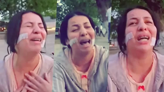 ولد الفشوش خسر لها وجهها ب 88 غرزة و القضاء عطاه شهرين د الحبس فقط و عائلتو فرحانة بالحكم