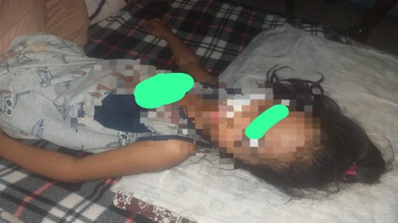 ساكنة المرينيين ففاس كاتعيش الخوف من الكلاب الضالة بعد ما طفلة تعرضات لهجوم شرس و كلب تسبب لها ف 36 غرزة