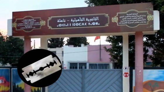 تلميذة ”شرملات” وجه صاحبتها بزيزوار وتم نقل الضحية في حالة حرجة إلى كلينيك بفاس