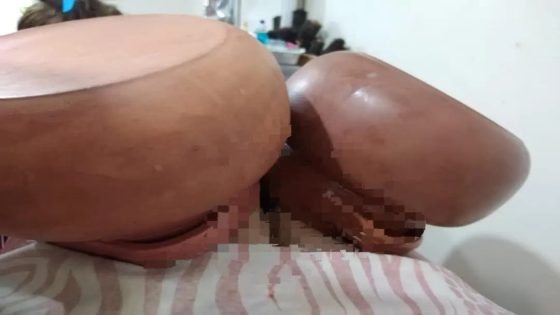 شابة ماتت بعد خضوعها لعملية تكبير الأرداف باستعمال تقنية “الكدرة الصحراوية”